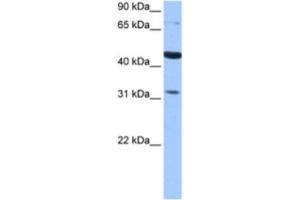 Western Blotting (WB) image for anti-Tetra-Peptide Repeat Homeobox-Like (TPRXL) antibody (ABIN2463460)