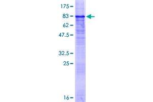Image no. 1 for Proline-Rich Transmembrane Protein 2 (PRRT2) (AA 1-340) protein (GST tag) (ABIN1316453)