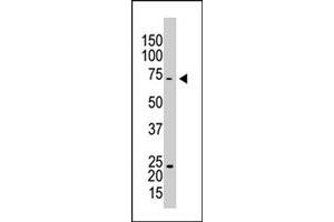The CAPRIN1 polyclonal antibody  is used in Western blot to detect CAPRIN1 in HL-60 cell lysate . (Caprin-1 anticorps  (AA 625-654))