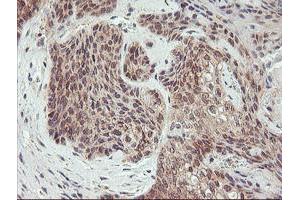 Image no. 4 for anti-1-Acylglycerol-3-Phosphate O-Acyltransferase 5 (Lysophosphatidic Acid Acyltransferase, Epsilon) (AGPAT5) antibody (ABIN1496498)