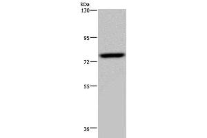 Western Blot analysis of PC3 cell using NR4A1 Polyclonal Antibody at dilution of 1:200 (NR4A1 anticorps)