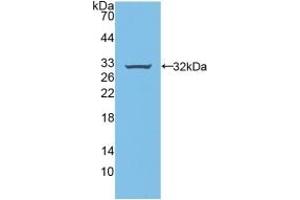 Detection of Recombinant BFP, Rat using Polyclonal Antibody to Brain Finger Protein (BFP)