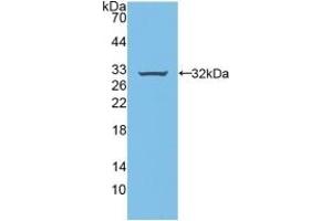 Detection of Recombinant BFP, Rat using Polyclonal Antibody to Brain Finger Protein (BFP) (RNF112 anticorps  (AA 256-504))