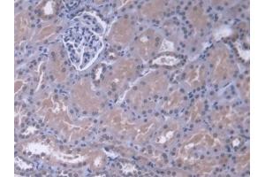 Detection of MAPK13 in Human Kidney Tissue using Polyclonal Antibody to Mitogen Activated Protein Kinase 13 (MAPK13)