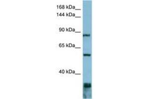 anti-Epidermal Growth Factor Receptor Pathway Substrate 8 (EPS8) (AA 647-696) antibody