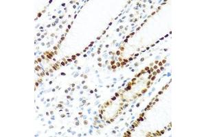 Immunohistochemistry of paraffin-embedded human stomach using KHDRBS2 antibody.