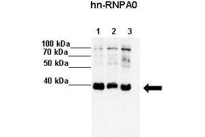 Lanes :  Lane 1: 20ug HeLa S3 lysate Lane 2: 20ug MCF7 lysate Lane 3: 20ug K562 lysate   Primary Antibody Dilution :   1:4000    Secondary Antibody :  Anti-rabbit-HRP   Secondary Antibody Dilution :   1:5000   Gene Name :  HNRPA0   Submitted by :  Anonymous (HNRNPA0 anticorps  (Middle Region))