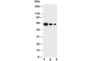 Western blot testing of IL23 p19 antibody and Lane 1:  recombinant mouse protein 10ng;  2: 5ng;  3: 2. (IL23A anticorps  (N-Term))