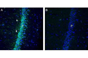 Expression of KCa2.
