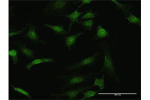 Immunofluorescence of purified MaxPab antibody to STK3 on HeLa cell.
