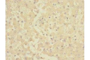 Immunohistochemistry of paraffin-embedded human liver tissue using ABIN7142967 at dilution of 1:100