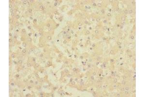 Immunohistochemistry of paraffin-embedded human liver tissue using ABIN7142967 at dilution of 1:100 (CHRNE anticorps  (AA 21-239))