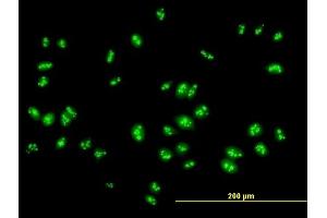 Immunofluorescence of purified MaxPab antibody to RSL1D1 on HeLa cell.