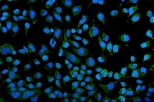 IF analysis of KCNQ1 using anti-KCNQ1 antibody (ABIN4886647).