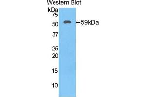 Western blot analysis of the recombinant protein. (HSD17B12 anticorps  (AA 11-291))