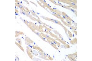 Immunohistochemistry of paraffin-embedded mouse heart using TRIM21 antibody at dilution of 1:100 (x40 lens). (TRIM21 anticorps)
