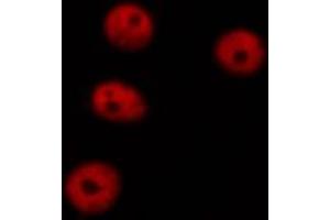 F7376 staining HEPG2 cells by ICC/IF. (DNMT1 anticorps  (Internal Region))