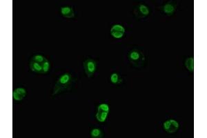 Immunofluorescent analysis of MCF-7 cells using ABIN7151258 at dilution of 1:100 and Alexa Fluor 488-congugated AffiniPure Goat Anti-Rabbit IgG(H+L) (TRIM33 anticorps  (AA 1-273))