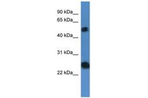 Image no. 1 for anti-Src-like-adaptor 2 (SLA2) (AA 66-115) antibody (ABIN6746842)