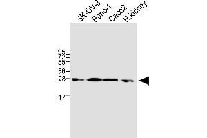 All lanes : Anti-TMEM97 Antibody (N-term) at 1:1000 dilution Lane 1: SK-OV-3 whole cell lysate Lane 2: Panc-1 whole cell lysate Lane 3: Caco2 whole cell lysate Lane 4: rat kidney lysate Lysates/proteins at 20 μg per lane. (TMEM97 anticorps  (N-Term))