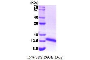 SDS-PAGE (SDS) image for Ferredoxin1 (FDX1) (AA 61-184) protein (HIS-T7) (ABIN666783) (Ferredoxin1 (FDX1) (AA 61-184) protein (HIS-T7))