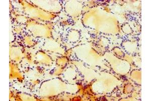 Immunohistochemistry of paraffin-embedded human thyroid tissue using ABIN7148757 at dilution of 1:100