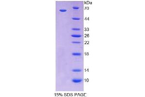 SDS-PAGE analysis of Human CDX2 Protein. (CDX2 Protéine)