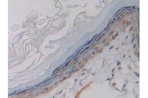 Detection of GP9 in Rat Skin Tissue using Polyclonal Antibody to Glycoprotein IX, Platelet (GP9)