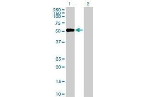 Lane 1: NHEDC2 transfected lysate ( 57.