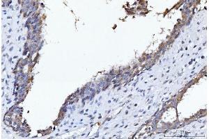 IHC analysis of CYB5B using anti-CYB5B antibody (ABIN7600312).