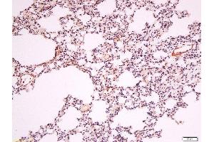 anti-Lipase, Endothelial (LIPG) (AA 301-400) antibody