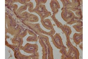 IHC image of ABIN7139908 diluted at 1:800 and staining in paraffin-embedded human prostate tissue performed on a Leica BondTM system.