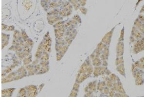 ABIN6276634 at 1/100 staining Human pancreas tissue by IHC-P. (PLA2G2A anticorps  (Internal Region))