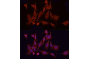 Immunofluorescence analysis of PC-12 cells using  Rabbit pAb (ABIN1678685, ABIN3015308, ABIN3015309 and ABIN6213977) at dilution of 1:150 (40x lens). (APAF1 anticorps  (AA 1-250))