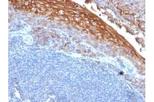 Image no. 1 for anti-Melanoma Cell Adhesion Molecule (MCAM) antibody (ABIN6153528) (MCAM anticorps)