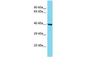 Host: Rabbit Target Name: CCDC86 Sample Type: MCF7 Whole Cell lysates Antibody Dilution: 1.