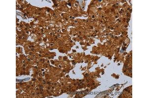Immunohistochemistry of Human brain  using ENTPD7 Polyclonal Antibody at dilution of 1:60 (ENTPD7 anticorps)