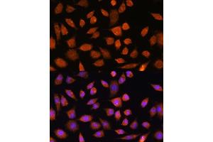 Immunofluorescence analysis of L929 cells using PLD3 Rabbit pAb (ABIN7269351) at dilution of 1:100. (PLD3 anticorps)