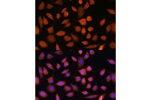 Immunofluorescence analysis of L929 cells using PLD3 Rabbit pAb (ABIN7269351) at dilution of 1:100.