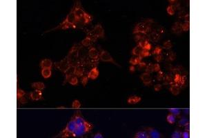 Immunofluorescence analysis of HeLa cells using B4GALT4 Polyclonal Antibody at dilution of 1:100. (B4GALT4 anticorps)