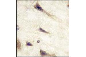 Immunohistochemistry (IHC) image for anti-EPH Receptor A5 (EPHA5) antibody (ABIN356398)