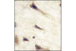 Immunohistochemistry (IHC) image for anti-EPH Receptor A5 (EPHA5) antibody (ABIN356398) (EPH Receptor A5 anticorps)
