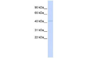 WB Suggested Anti-MITF Antibody Titration:  0. (MITF anticorps  (Middle Region))