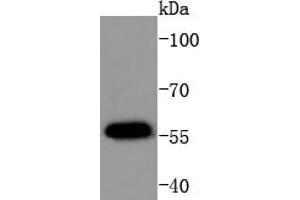 MCF-7 Cell lysates, probed with AKT1(T450) (4A3) Monoclonal Antibody  at 1:1000 overnight at 4˚C. (AKT1 anticorps  (pThr450))