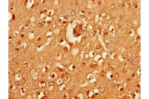 Immunohistochemistry of paraffin-embedded human brain tissue using ABIN7155237 at dilution of 1:100 (HRH3 anticorps  (AA 236-332))