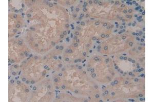 IHC-P analysis of Human Kidney Tissue, with DAB staining. (ADCY7 anticorps  (AA 806-1052))