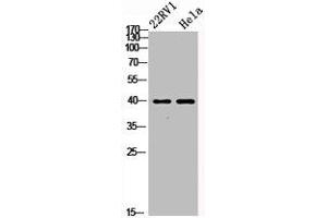 Western Blot analysis of 22RV1 HELA cells using PKAα/β/γ cat Polyclonal Antibody (PRKACA + PRKACB + PRKACG anticorps)