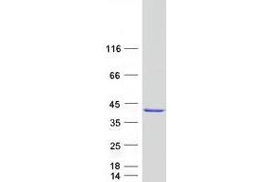 Validation with Western Blot