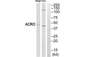 Western blot analysis of extracts from HEPG2 cells and COLO cells, using ACRO (heavy chain, Cleaved-Ile43) antibody.