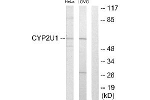 Western blot analysis of extracts from HeLa cells and Lovo cells, using Cytochrome P450 2U1 antibody.
